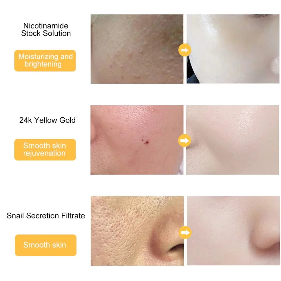 24k Goud Hyaluronzuur Gezicht Serum